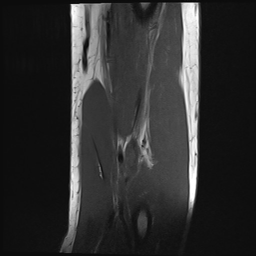 Click on the Serie image to view the images of Wieszt, Gnter